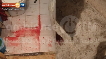 المناقع : في تصرف بربري كهل يعتدي على جاره بآلة حادة